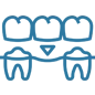 Dental bridge connecting missing tooth between two adjacent teeth illustration.