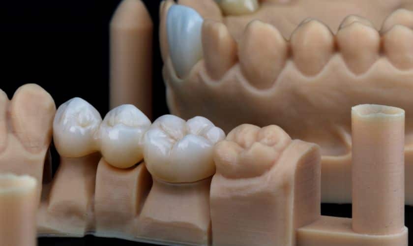 Dental Crowns Paradise-Valley