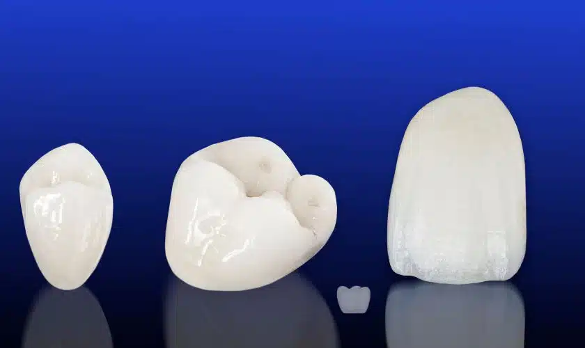 Strengthen Weak Teeth The Role of Dental Crowns