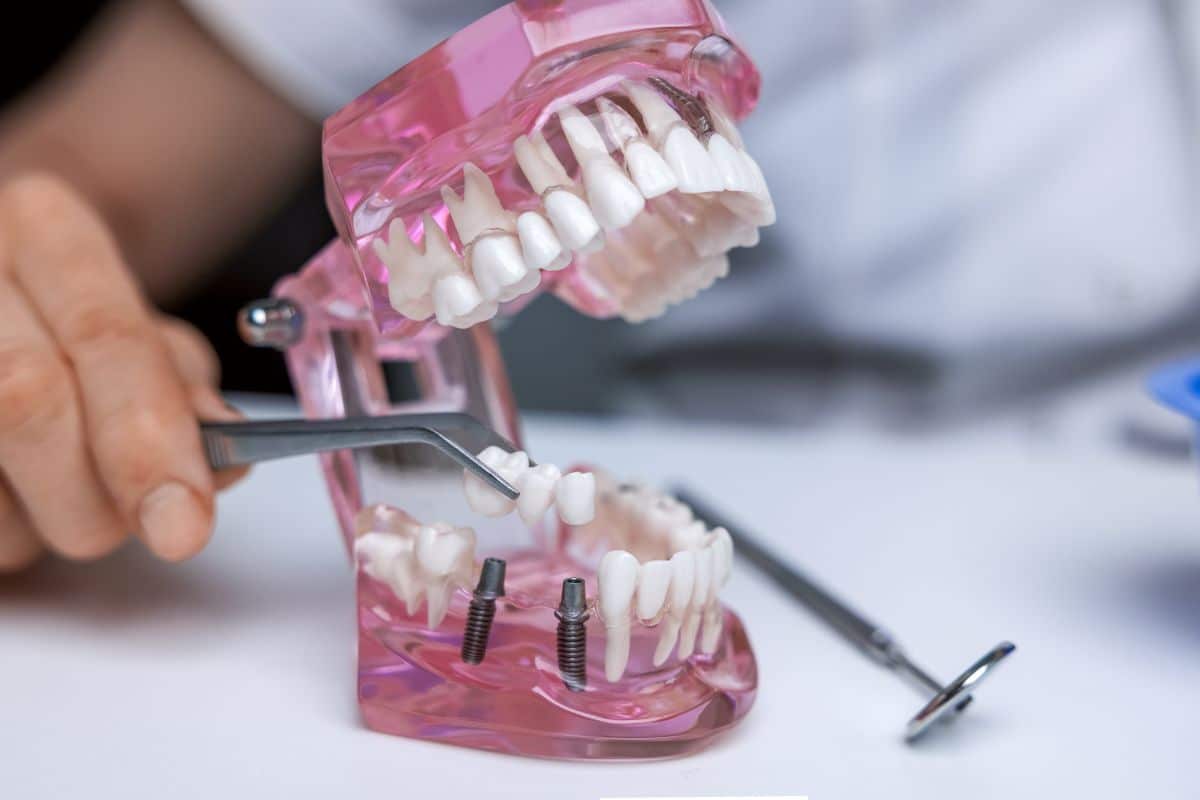 is teeth in an hour safe