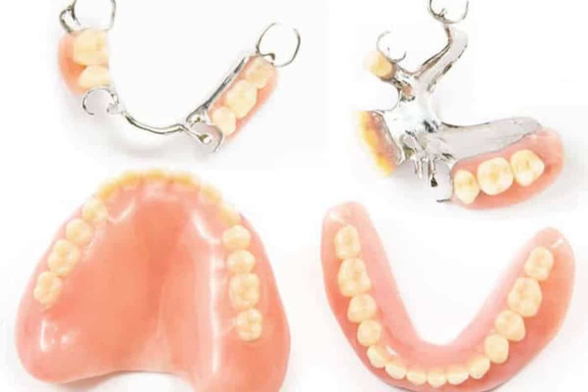 Partial Denture models available at Paradise Valley Dental
