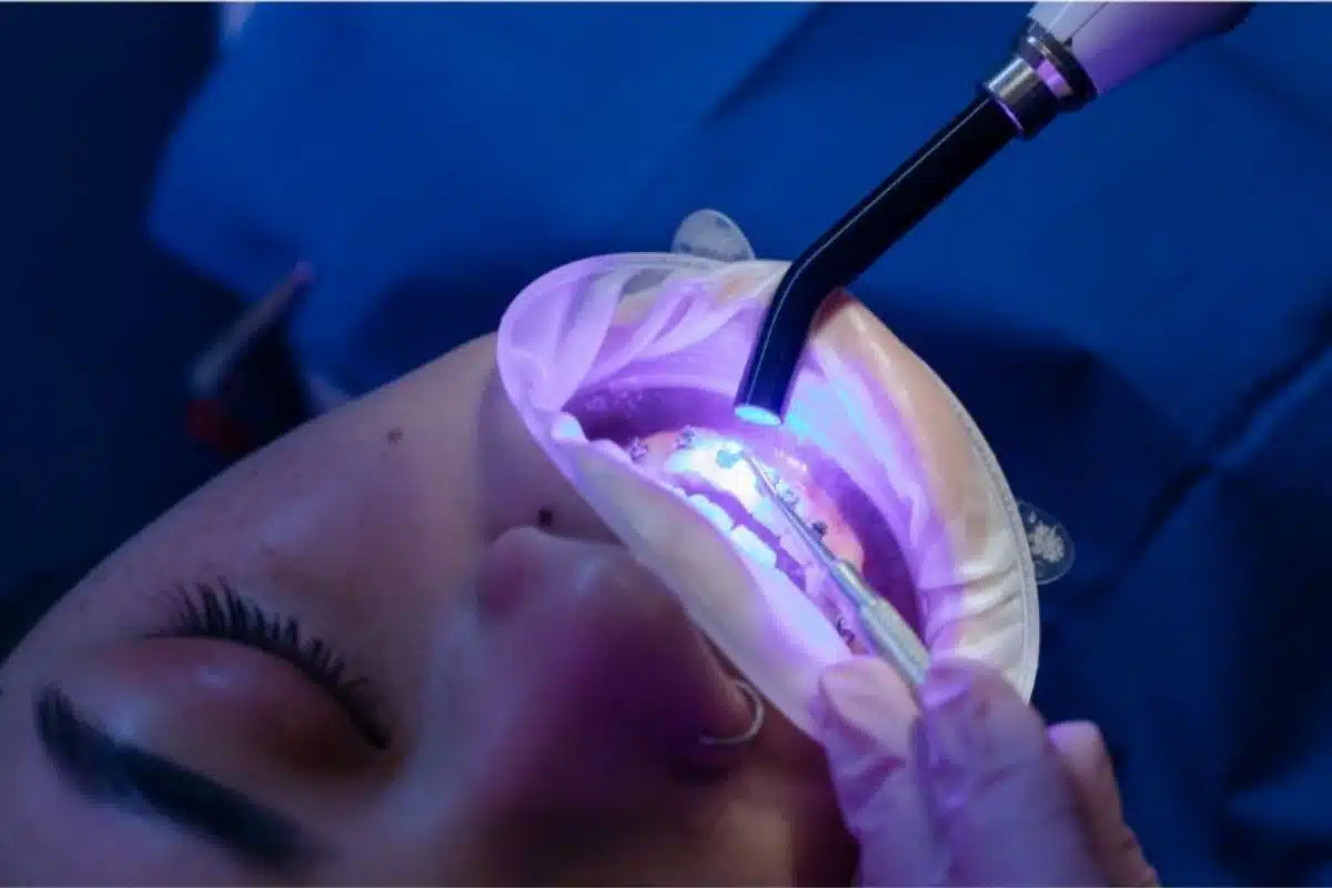 is-teeth-whitening-safe-during-pregnancy