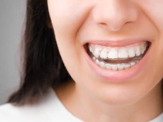 invisalign-paradise-valley-az