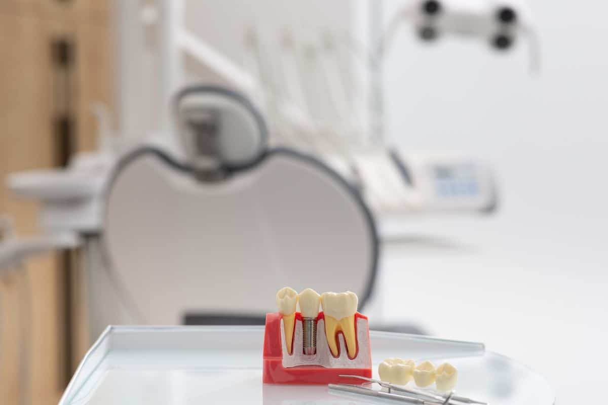 Featured image for “How Do I Choose a Dental Implants Provider in Paradise Valley?”